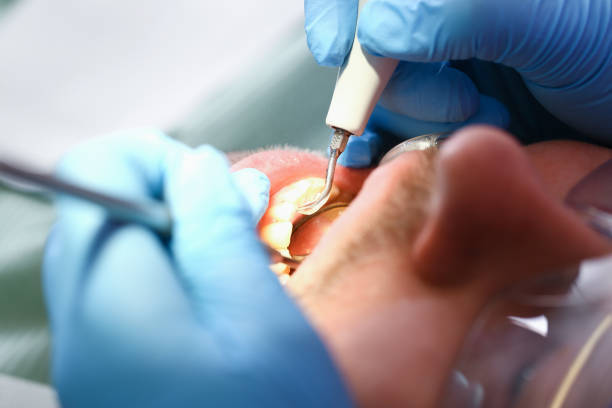 Best Emergency Dental Care for Abscessed Tooth in Woodruff, SC